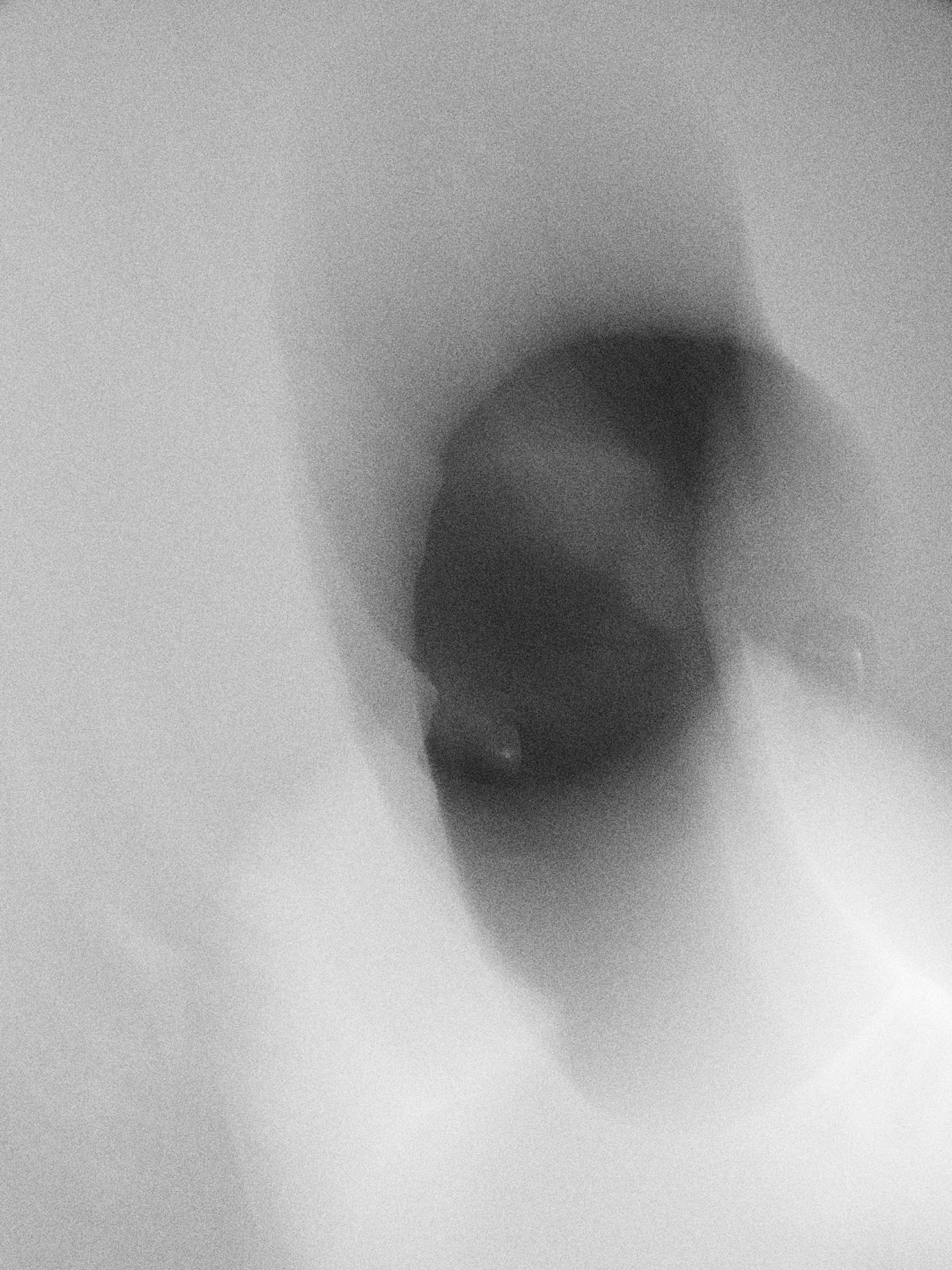 New York Photography Awards Winner - Uncertainty